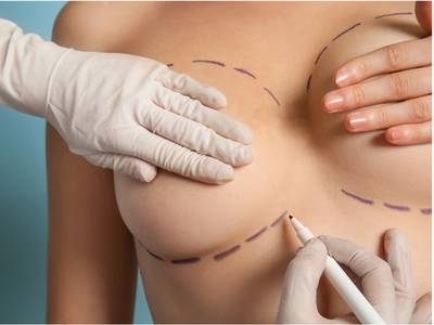Breast Augmentation
