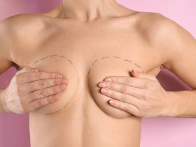 Breast Lift