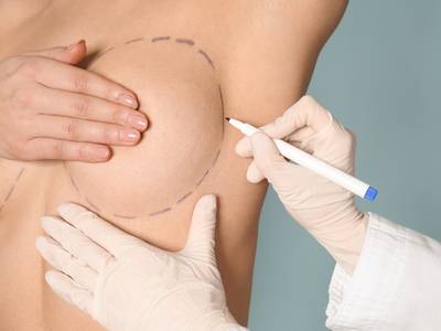 Breast Reduction