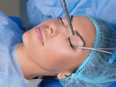 Facelift Surgery