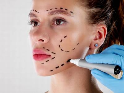 Facelift Surgery